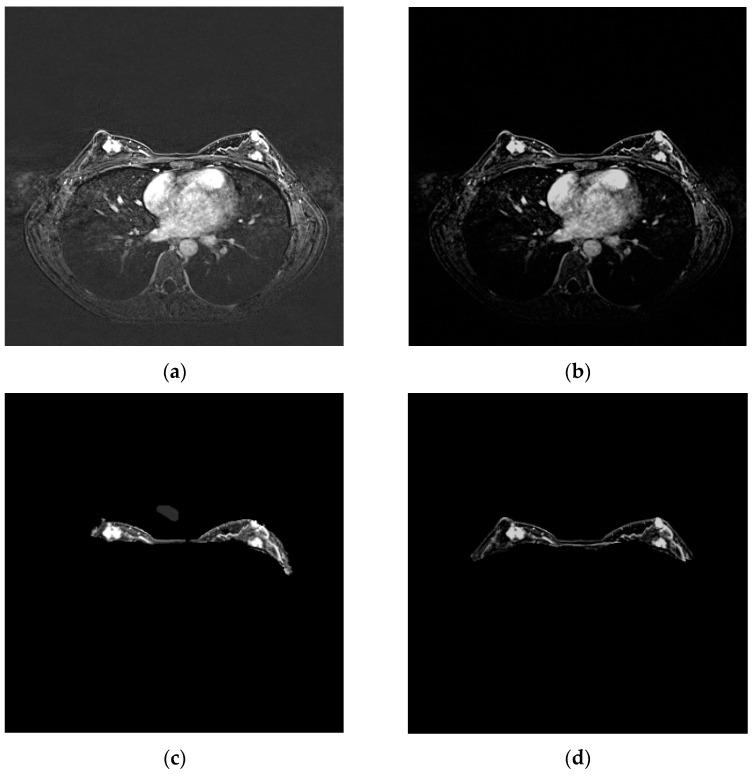 https://cdn.ncbi.nlm.nih.gov/pmc/blobs/b49a/11673413/1c86da592509/bioengineering-11-01217-g005.jpg