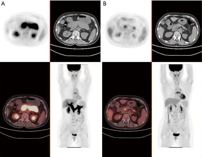 https://cdn.ncbi.nlm.nih.gov/pmc/blobs/b49d/10727812/05804200b567/hbsn-12-06-991-f1.jpg