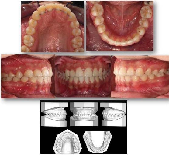 https://cdn.ncbi.nlm.nih.gov/pmc/blobs/b49e/6236032/3bb324adddb3/OAMJMS-6-1882-g005.jpg
