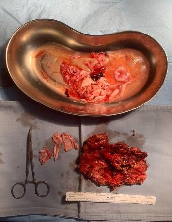 https://cdn.ncbi.nlm.nih.gov/pmc/blobs/b4a3/12356676/b8dadd57dd9b/CRIGM2025-1244948.003.jpg