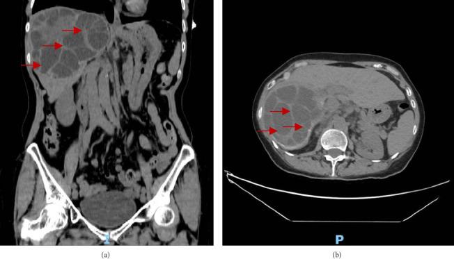 https://cdn.ncbi.nlm.nih.gov/pmc/blobs/b4a3/12356676/ef88825d9369/CRIGM2025-1244948.001.jpg