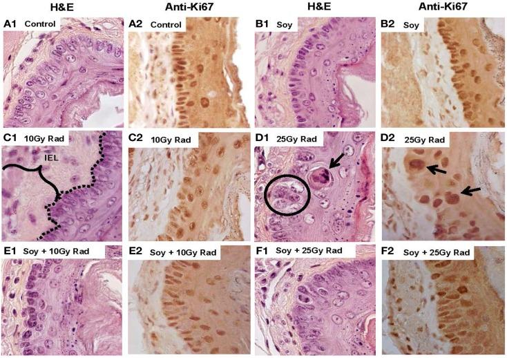 https://cdn.ncbi.nlm.nih.gov/pmc/blobs/b4a6/4617099/908235d91d86/fonc-05-00238-g005.jpg