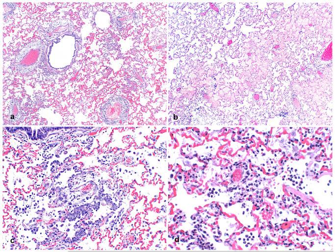 https://cdn.ncbi.nlm.nih.gov/pmc/blobs/b4a8/8589170/877c8c6f4be4/ppat.1009952.g002.jpg
