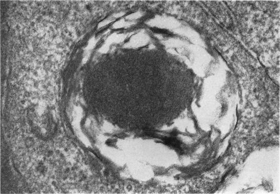 https://cdn.ncbi.nlm.nih.gov/pmc/blobs/b4ae/1271405/95253089453f/janat00319-0016-a.jpg