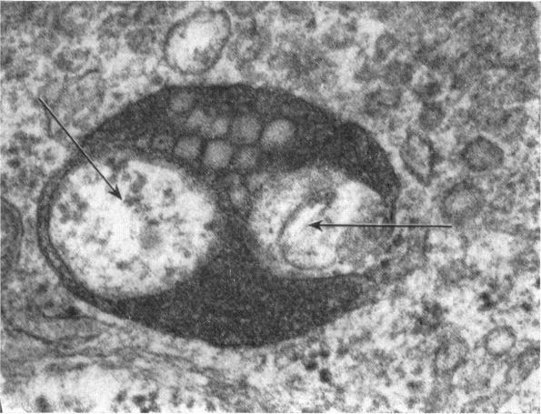 https://cdn.ncbi.nlm.nih.gov/pmc/blobs/b4ae/1271405/cc992d2b6818/janat00319-0015-a.jpg