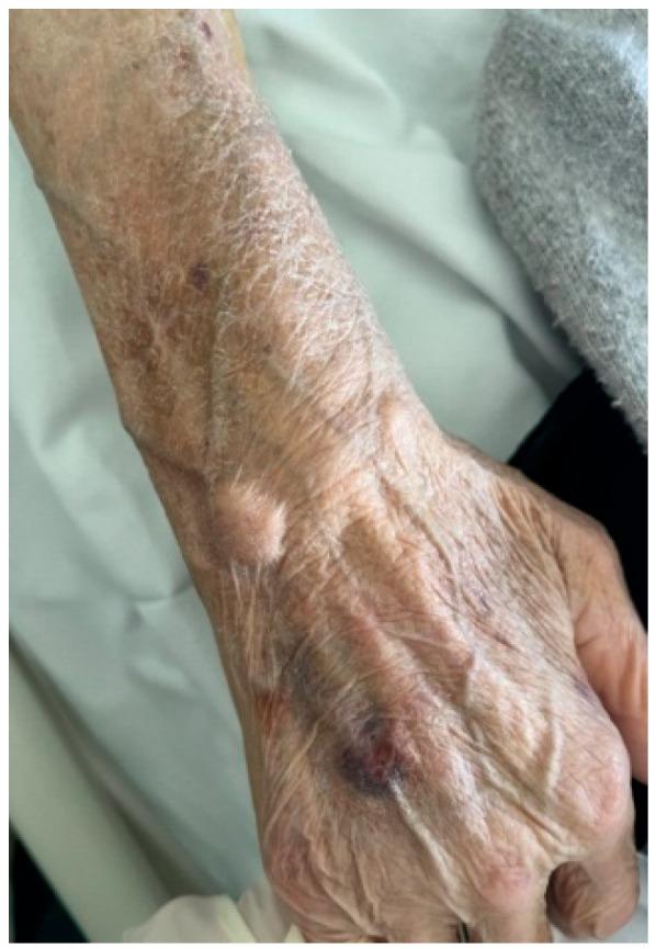 https://cdn.ncbi.nlm.nih.gov/pmc/blobs/b4b2/10304890/1f252776c7b2/jof-09-00683-g002.jpg