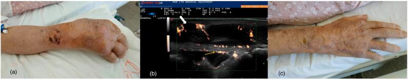 https://cdn.ncbi.nlm.nih.gov/pmc/blobs/b4b2/10304890/8e23072e3cfd/jof-09-00683-g001.jpg