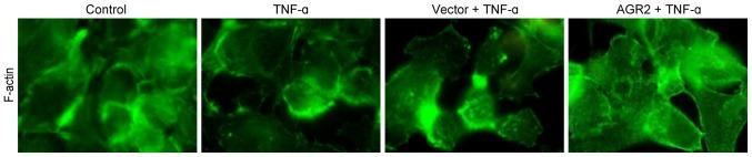 https://cdn.ncbi.nlm.nih.gov/pmc/blobs/b4b5/5403182/87add722832e/IJMM-39-05-1206-g04.jpg