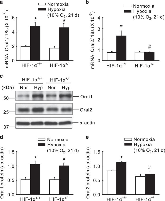 https://cdn.ncbi.nlm.nih.gov/pmc/blobs/b4b5/5702854/f758537f8c65/cddiscovery201774-f2.jpg