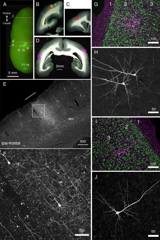 https://cdn.ncbi.nlm.nih.gov/pmc/blobs/b4b6/5324647/49235fdcf34e/DNEU-77-354-g002.jpg