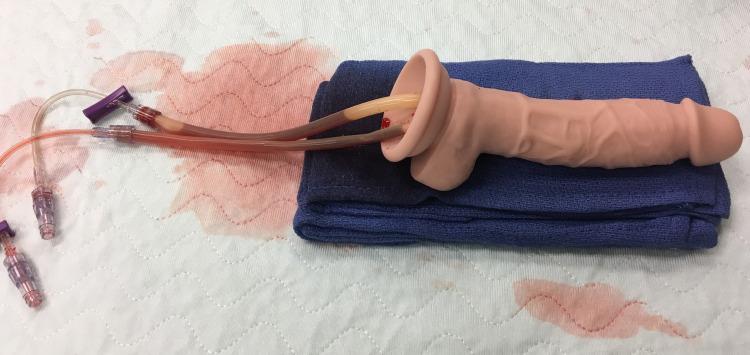 https://cdn.ncbi.nlm.nih.gov/pmc/blobs/b4bd/8292470/0f2f4ac883b8/cureus-0013-00000015782-i02.jpg