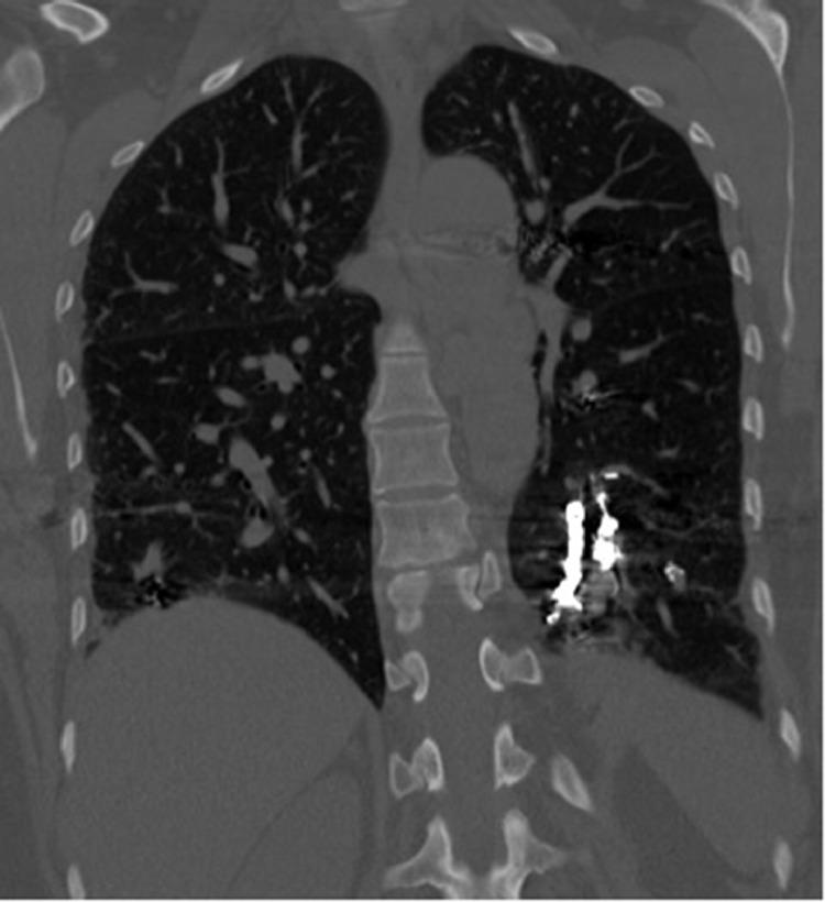 https://cdn.ncbi.nlm.nih.gov/pmc/blobs/b4bf/9309579/14c711e17902/gr5.jpg