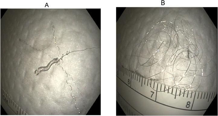 https://cdn.ncbi.nlm.nih.gov/pmc/blobs/b4bf/9309579/a4c4ef4f5cab/gr4.jpg