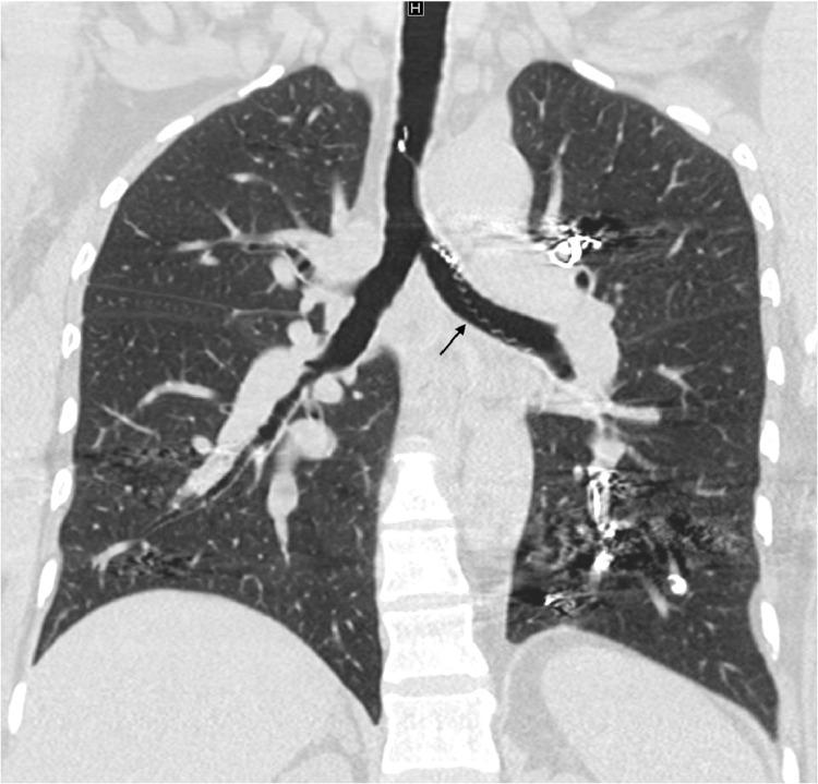 https://cdn.ncbi.nlm.nih.gov/pmc/blobs/b4bf/9309579/e0fadd85ee20/gr2.jpg