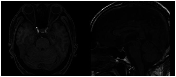 https://cdn.ncbi.nlm.nih.gov/pmc/blobs/b4c1/10773211/58bf67cc1538/ol-27-02-14199-g03.jpg