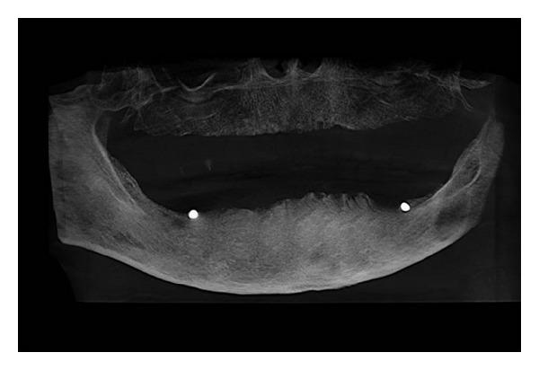 https://cdn.ncbi.nlm.nih.gov/pmc/blobs/b4c1/4054875/2bd0372e1bd8/CRID2014-215378.002.jpg