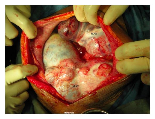 https://cdn.ncbi.nlm.nih.gov/pmc/blobs/b4cc/3523574/1701fabf3d77/CRIM.ONCMED2012-120727.001.jpg