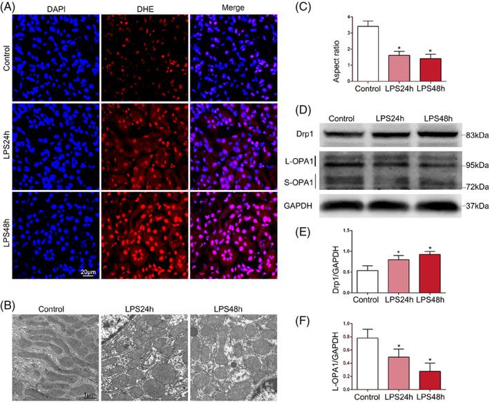 https://cdn.ncbi.nlm.nih.gov/pmc/blobs/b4cc/9890524/05b16ba16a5c/CPR-56-e13362-g009.jpg