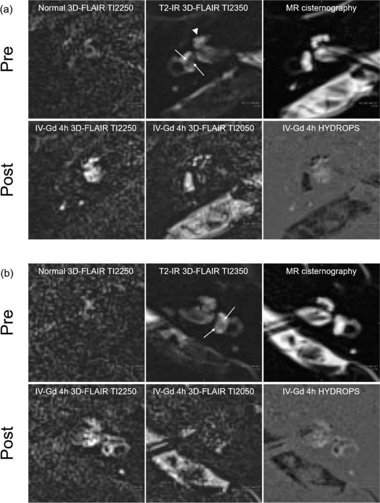https://cdn.ncbi.nlm.nih.gov/pmc/blobs/b4ce/10449551/b8752c71ee85/mrms-22-335-g6.jpg