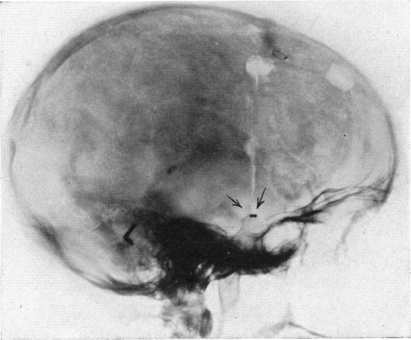 https://cdn.ncbi.nlm.nih.gov/pmc/blobs/b4d3/1386933/582424b049f9/annsurg00520-0025-a.jpg