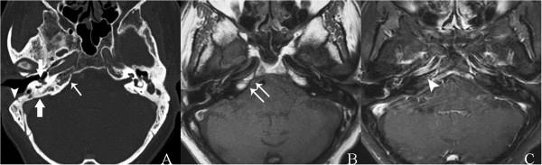 https://cdn.ncbi.nlm.nih.gov/pmc/blobs/b4d4/4086707/787b28244e36/1752-1947-8-217-2.jpg