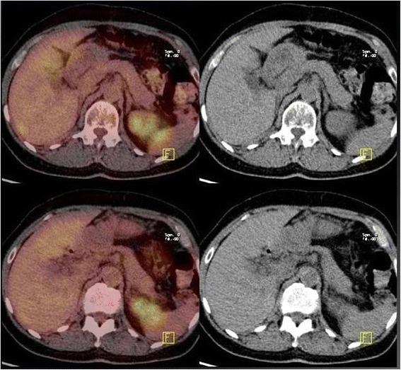https://cdn.ncbi.nlm.nih.gov/pmc/blobs/b4d6/5936016/5adbdf5dbd66/12885_2018_4469_Fig4_HTML.jpg