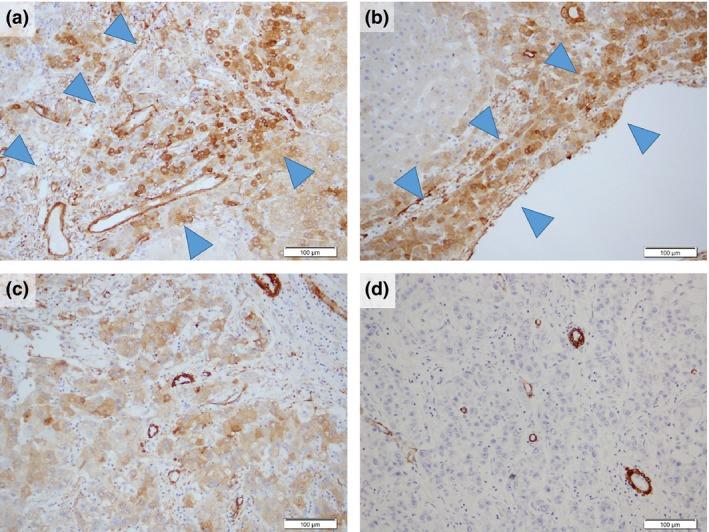 https://cdn.ncbi.nlm.nih.gov/pmc/blobs/b4da/4832853/2ecc1d432d8a/CAS-107-543-g006.jpg