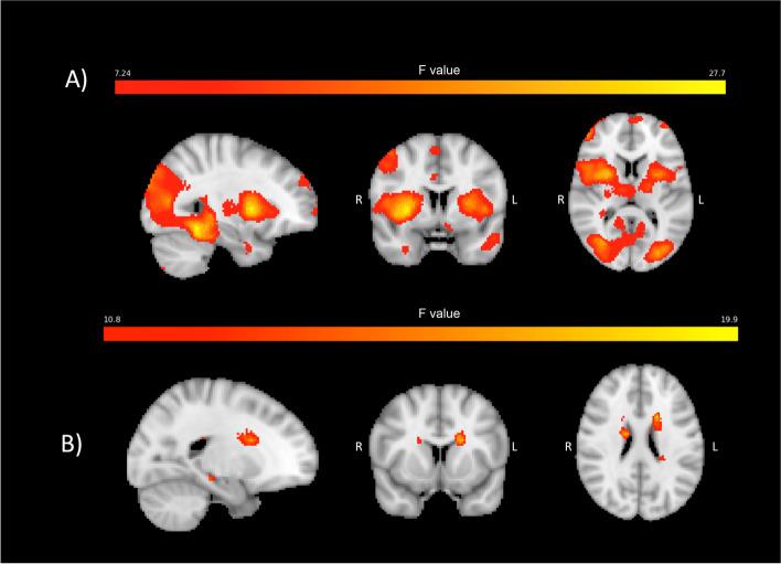 https://cdn.ncbi.nlm.nih.gov/pmc/blobs/b4df/9749190/6b6431f29095/10194_2022_1526_Fig2_HTML.jpg