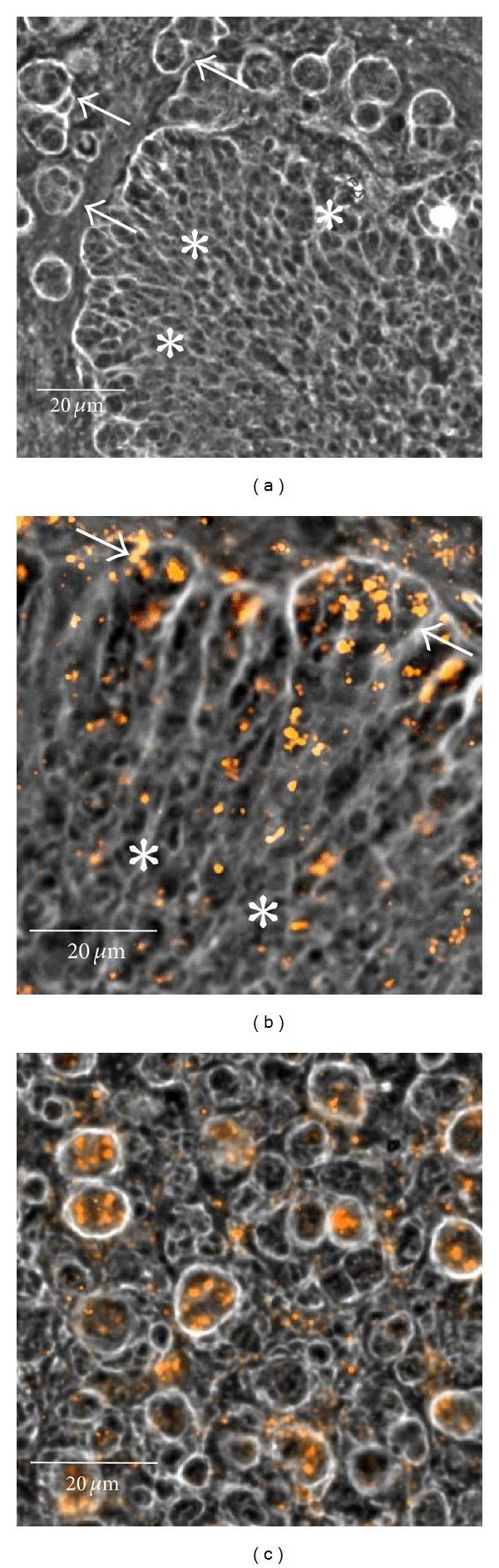 https://cdn.ncbi.nlm.nih.gov/pmc/blobs/b4e6/3697272/176dcdb7bfc2/ARCH2013-102972.001.jpg