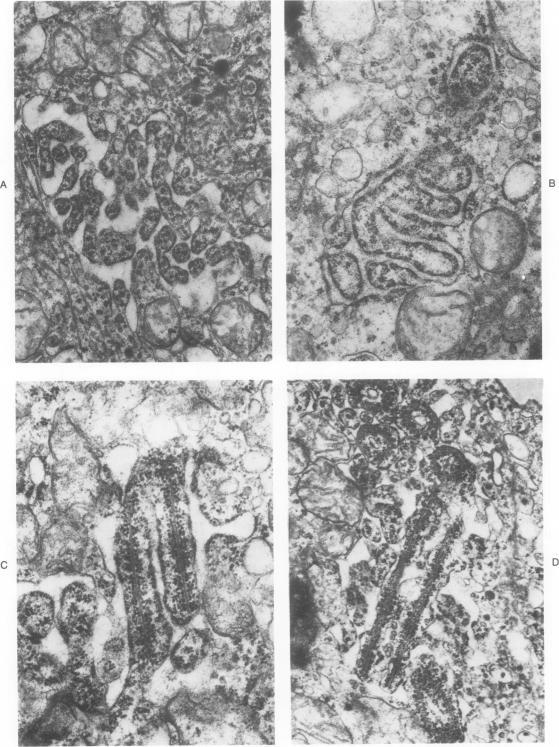 https://cdn.ncbi.nlm.nih.gov/pmc/blobs/b4e9/2032115/9bd21e428213/amjpathol00403-0048-a.jpg