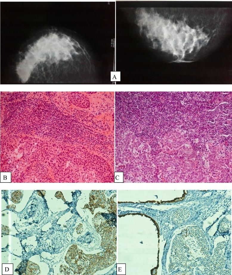 https://cdn.ncbi.nlm.nih.gov/pmc/blobs/b4ee/3913155/d9f283c51794/IJHOSCR-8-046-g002.jpg