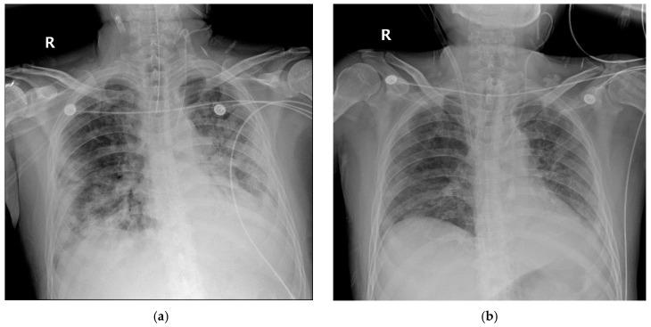 https://cdn.ncbi.nlm.nih.gov/pmc/blobs/b4ef/7692694/20373641d26b/medicina-56-00570-g006.jpg