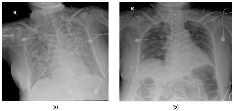 https://cdn.ncbi.nlm.nih.gov/pmc/blobs/b4ef/7692694/431f071a3fe1/medicina-56-00570-g004.jpg