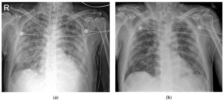 https://cdn.ncbi.nlm.nih.gov/pmc/blobs/b4ef/7692694/505c69f1955f/medicina-56-00570-g002.jpg