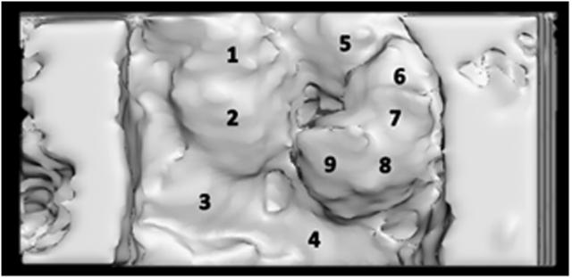 https://cdn.ncbi.nlm.nih.gov/pmc/blobs/b4f1/11518862/283f564fbcd2/gr3.jpg