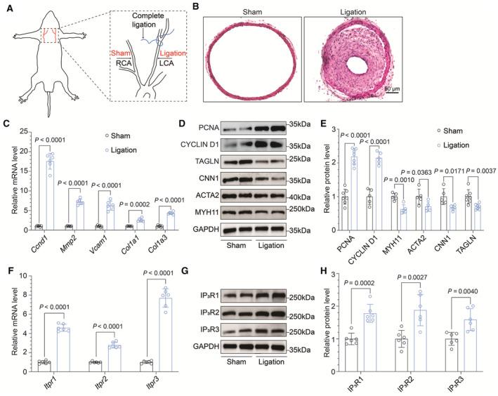https://cdn.ncbi.nlm.nih.gov/pmc/blobs/b4f2/11964046/af9a45544d3a/JAH3-13-e034203-g003.jpg