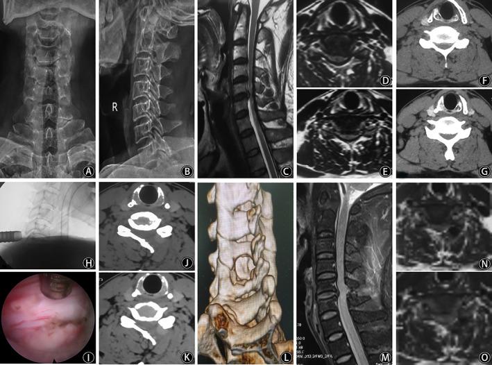 https://cdn.ncbi.nlm.nih.gov/pmc/blobs/b4fb/9087468/1579050fd4d6/OS-14-876-g001.jpg