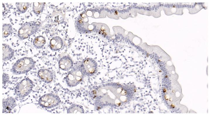 https://cdn.ncbi.nlm.nih.gov/pmc/blobs/b4ff/10531936/b7cf72867a3d/jcm-12-06064-g002.jpg