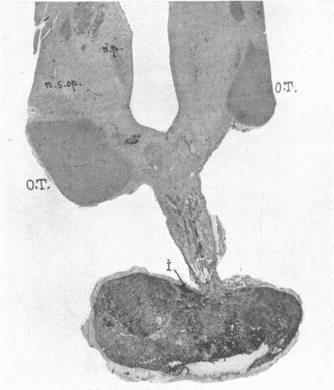 https://cdn.ncbi.nlm.nih.gov/pmc/blobs/b506/1249341/0cffe2d6523f/janat00547-0023-a.jpg