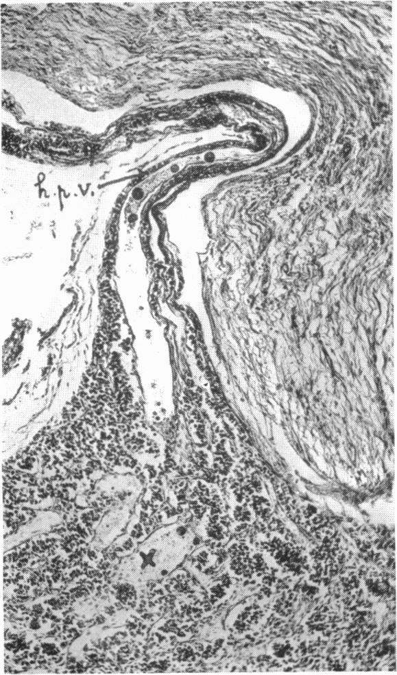 https://cdn.ncbi.nlm.nih.gov/pmc/blobs/b506/1249341/5134c3d1f5aa/janat00547-0026-a.jpg