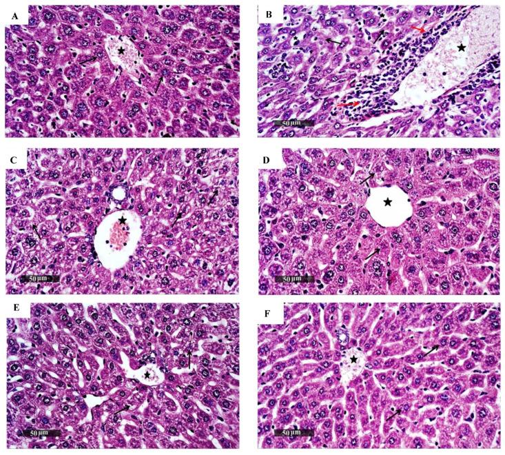 https://cdn.ncbi.nlm.nih.gov/pmc/blobs/b506/8945686/c00af38e5ef8/biomedicines-10-00722-g002.jpg