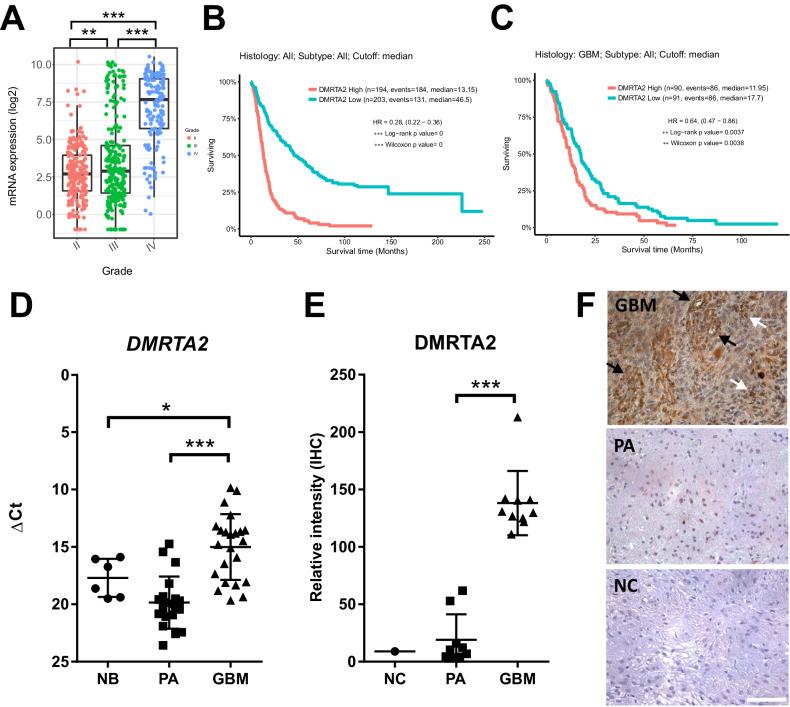 https://cdn.ncbi.nlm.nih.gov/pmc/blobs/b50b/10954651/cbe4de6bf1a3/41419_2024_6603_Fig1_HTML.jpg