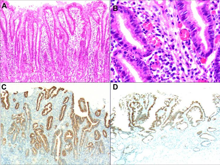 https://cdn.ncbi.nlm.nih.gov/pmc/blobs/b50c/9273833/4c086bb1277e/IDR-15-3619-g0004.jpg