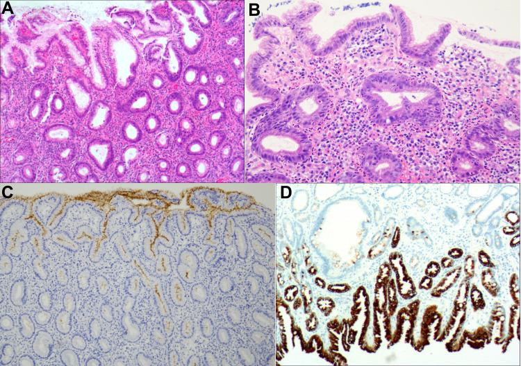 https://cdn.ncbi.nlm.nih.gov/pmc/blobs/b50c/9273833/6328d7a388aa/IDR-15-3619-g0003.jpg