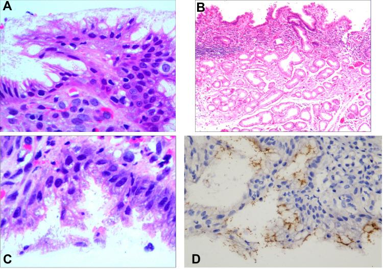 https://cdn.ncbi.nlm.nih.gov/pmc/blobs/b50c/9273833/a7341e97b8fa/IDR-15-3619-g0002.jpg