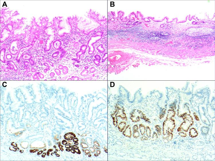https://cdn.ncbi.nlm.nih.gov/pmc/blobs/b50c/9273833/dd5dade2d873/IDR-15-3619-g0005.jpg