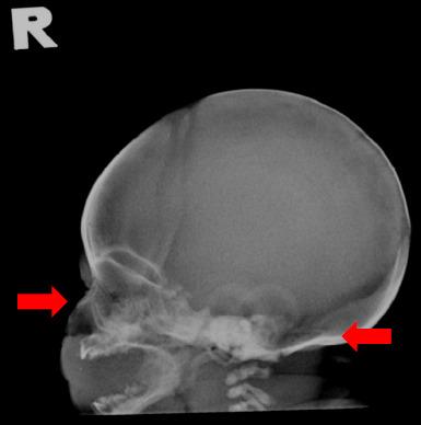 https://cdn.ncbi.nlm.nih.gov/pmc/blobs/b512/11627173/636e069ebc1a/MFP-19-66-g2.jpg