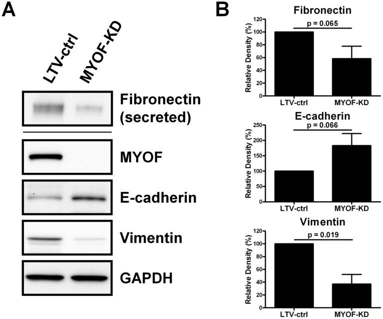 https://cdn.ncbi.nlm.nih.gov/pmc/blobs/b512/3384637/e5e8402facb4/pone.0039766.g004.jpg