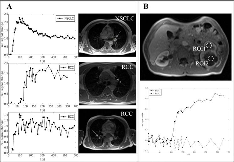 https://cdn.ncbi.nlm.nih.gov/pmc/blobs/b514/4991441/9b6274aca329/oncotarget-07-20109-g005.jpg