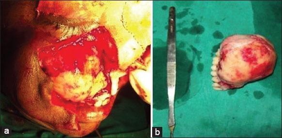 https://cdn.ncbi.nlm.nih.gov/pmc/blobs/b51c/4479764/d95f19421f3f/JIOH-7-115-g003.jpg
